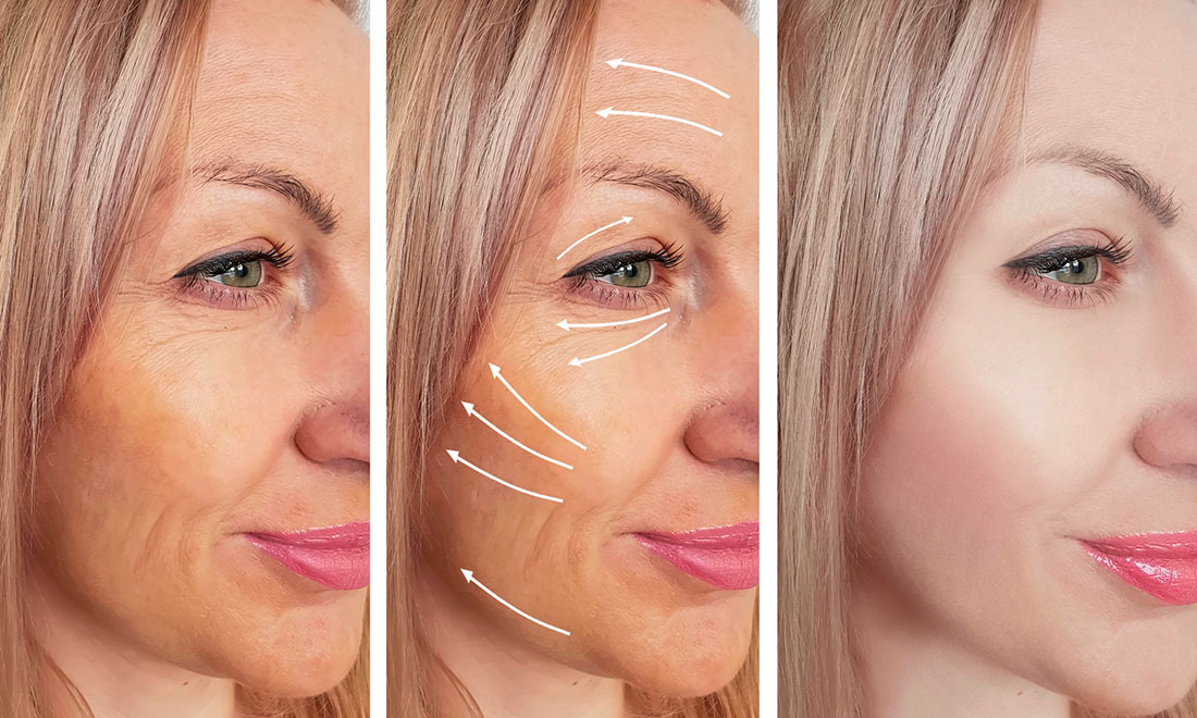 Kolagen a st&aacute;ř&iacute;